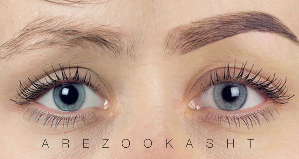 دلایل ریزش ابرو