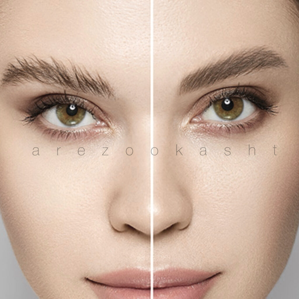درباره کاشت ابرو